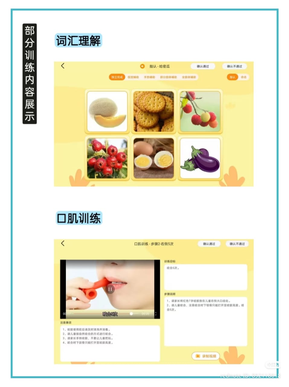 小南AI学习平板 - 专为特殊学习需求宝贝设计的智能学习与康复助手 - Image 8